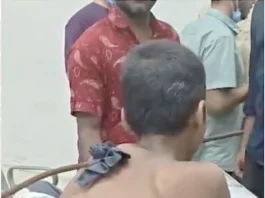 சிறுவன் தோளில் பாய்ந்த கம்பியை அகற்றி மருத்துவர்கள் சாதனை
