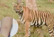 புலியுடன் செல்பி எடுத்தபோது நகத்தில் கீறியது; தப்பி பிழைத்த சிறுமி