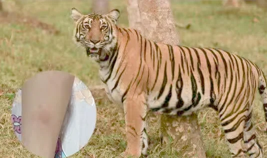 புலியுடன் செல்பி எடுத்தபோது நகத்தில் கீறியது; தப்பி பிழைத்த சிறுமி